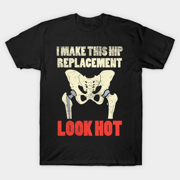 Hot Hip Replacement T-Shirt by maxdax